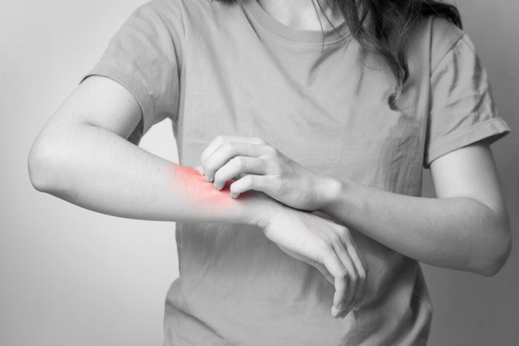 Women scratch itchy arm with hand.